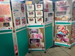 25 FEB 2025 BULAN KESEDARAN KANSER MULUT 2025